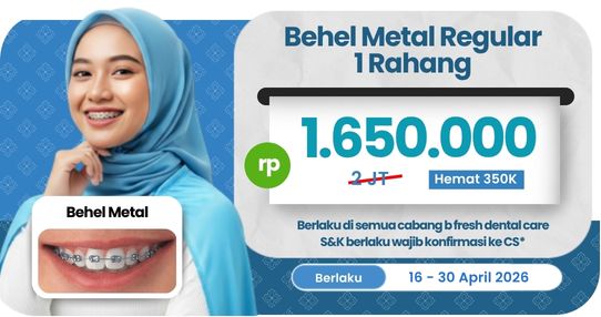 Behel Metal Regular
